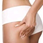 Traitement de la cellulite